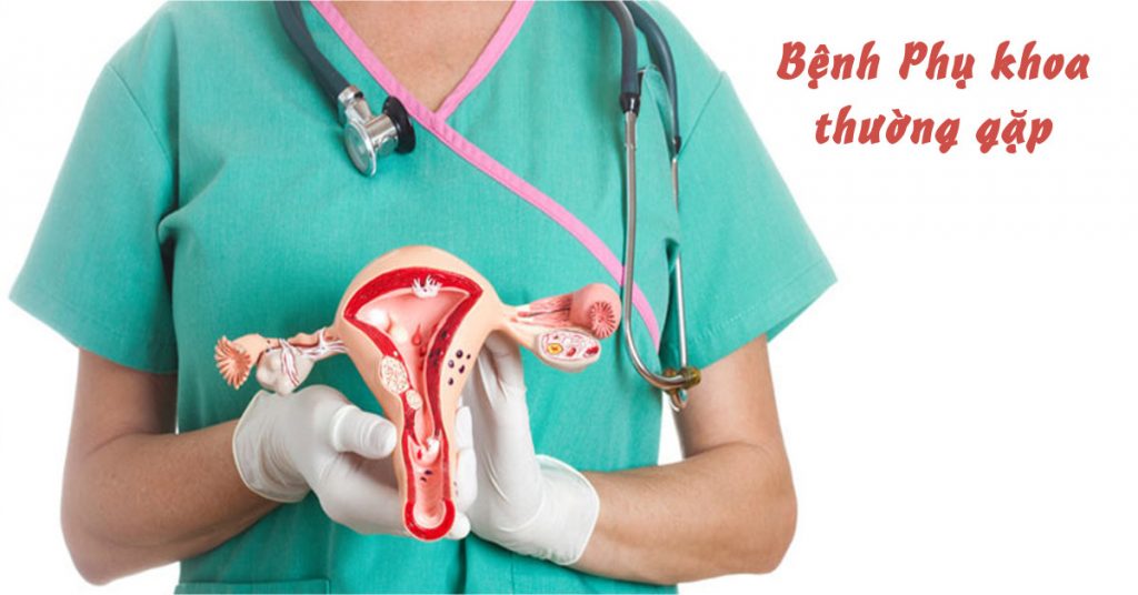 Dấu hiệu viêm phụ khoa: Nguyên nhân, triệu chứng và cách điều trị