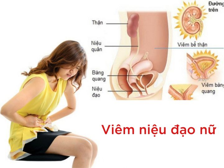 Cách nhận biết viêm âm đạo - 7 dấu hiệu không thể bỏ qua