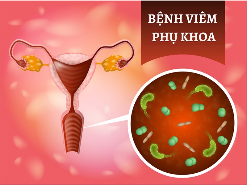 Phương pháp điều trị viêm âm đạo do Trichomonas